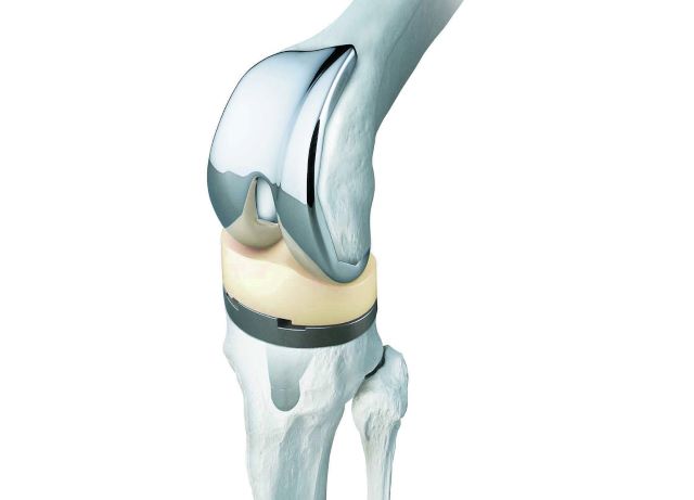 orthopedic implants manufacturer