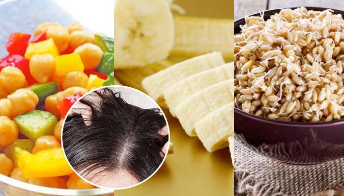 The 4 Best Natural Ways To Treat Dandruff