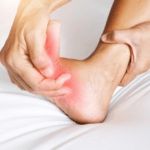 managing and preventing heel pain