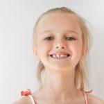 kids dental sealants