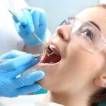 teeth whitening