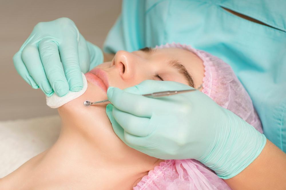 Acne Extraction