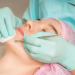 acne facial treatment