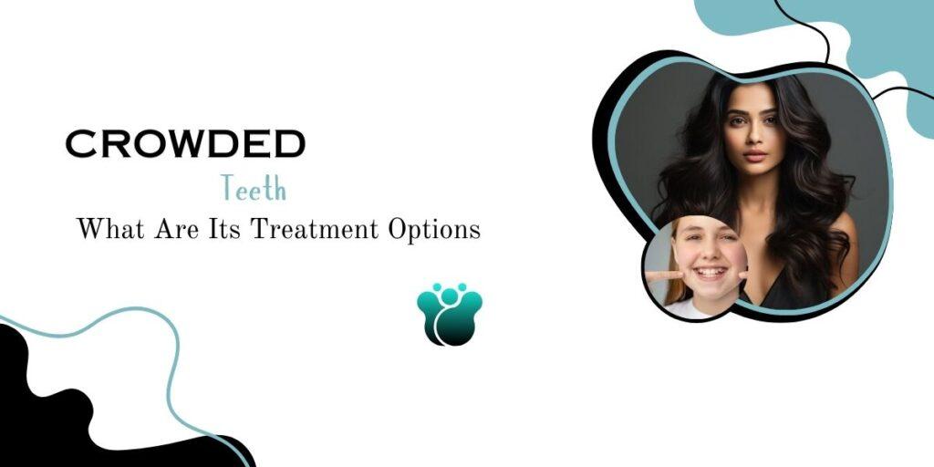 invisalign discount UK