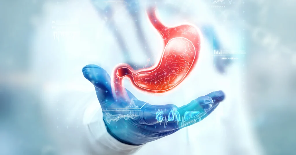 bariatric surgery