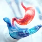 bariatric surgery