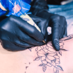 hair and tattoo removal