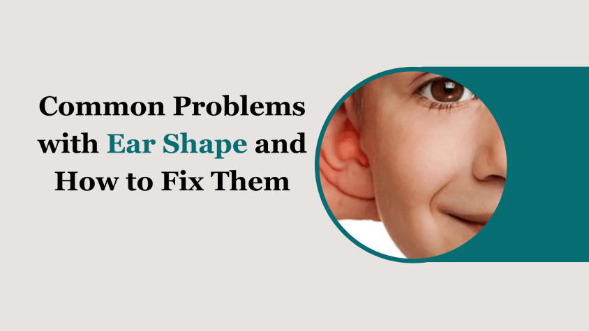 ear shape