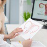 gynecological cancer treatments